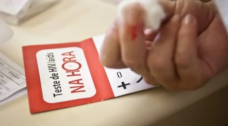 Aids-Brasil-tem-alta-de-casos-mas-menor-mortalidad0129929000202412122322-ScaleDownProportional (1)