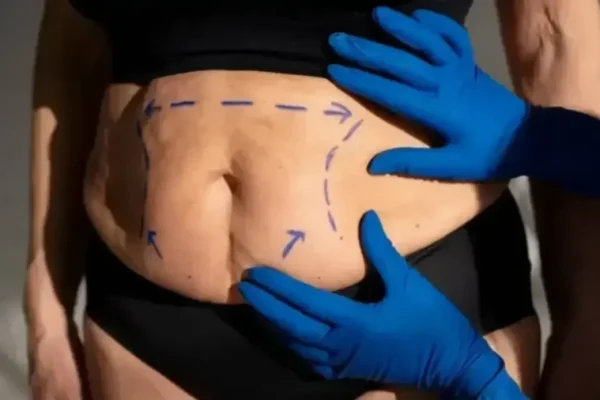 cirurgia-plastica